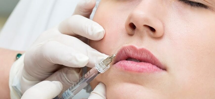 Що таке філери: Все про популярні препарати для омолодження шкіри