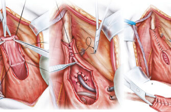 Що таке нориця: види, причини та лікування цього захворювання