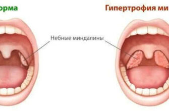 Гланди: Що Це Таке Та Яку Роль Вони Відіграють у Вашому Організмі?