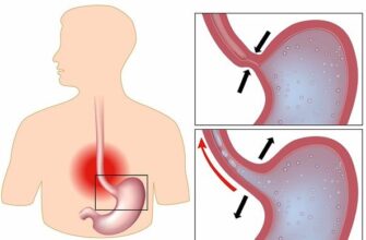 Що таке печія: основні причини, симптоми та методи лікування