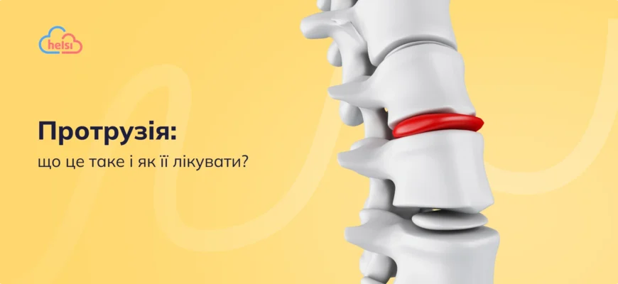 Що таке протрузія: причини, симптоми та лікування патології хребта