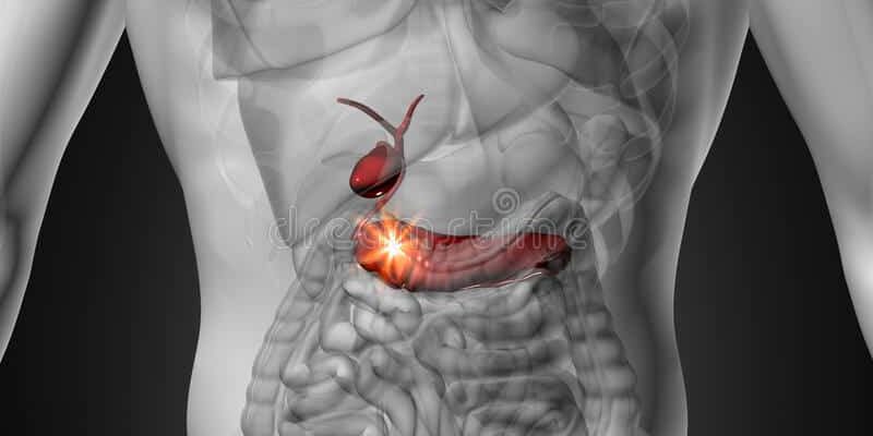 Що таке перитоніт: причини, симптоми та методи лікування захворювання