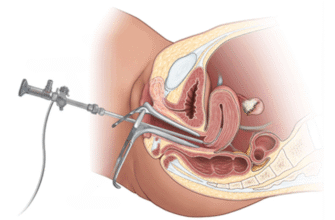 Гістологія в гінекології: важливість та застосування в медицині