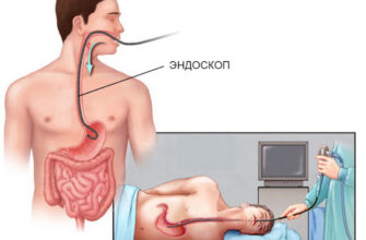 Гастроскопія: що це таке, як проводять та для чого потрібна процедура