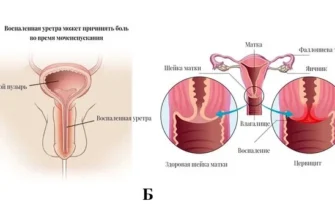 Що таке гонорея: симптоми, діагностика та методи лікування захворювання