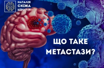 Що таке метастази: причини, симптоми та методи лікування раку