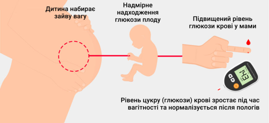 Що таке діабет: основи, симптоми та поради для контролю хвороби