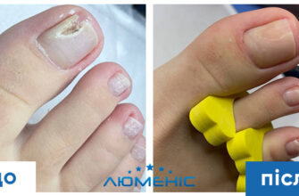 Все про подологію: що це таке і чому важливо доглядати за стопами