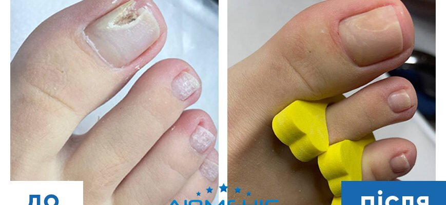 Все про подологію: що це таке і чому важливо доглядати за стопами