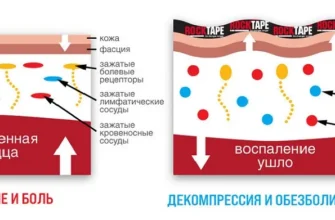 Що таке тейпи: застосування та переваги в спортивній медицині