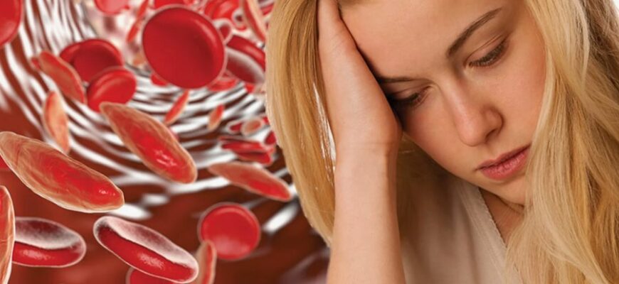 Анемія: визначення, симптоми та основні причини виникнення захворювання