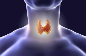 Что такое базедова болезнь: симптомы, причины и лечение заболевания
