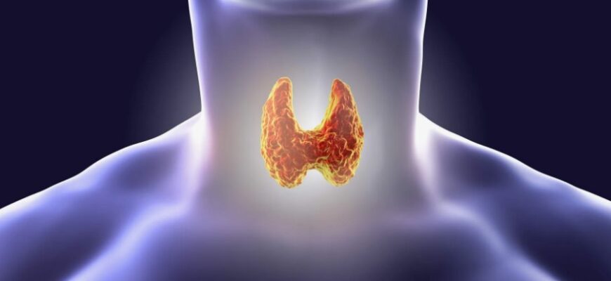 Что такое базедова болезнь: симптомы, причины и лечение заболевания