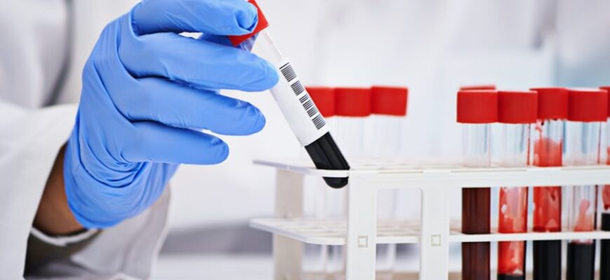 Биохимический анализ крови: ключ к пониманию здоровья вашего тела