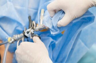 Франшиза в автоцивілці: що це таке і як вона впливає на страховку?