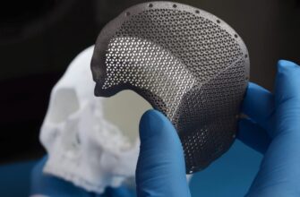 Что такое импланты: виды, преимущества и установка для здоровья