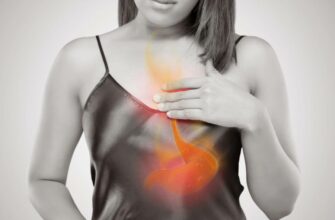 Що таке ізжога: причини, симптоми та ефективні методи лікування