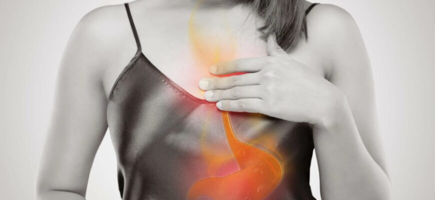 Що таке ізжога: причини, симптоми та ефективні методи лікування