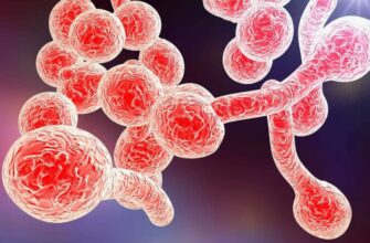 Кандидоз: Причины, Симптомы и Эффективные Методы Лечения