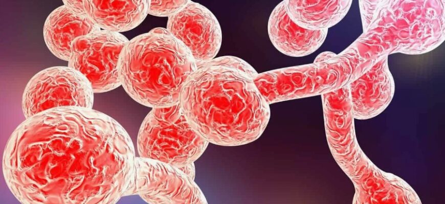 Кандидоз: Причины, Симптомы и Эффективные Методы Лечения