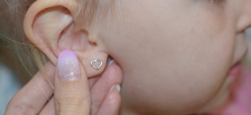 Медичне золото: Секрети популярності та використання в ювелірних виробах