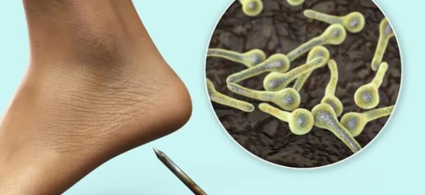 Що таке пандус: важливість та правила облаштування для зручності Що таке пандус: важливість та правила облаштування для зручності