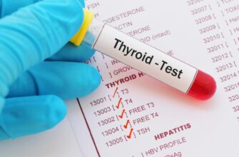 Що таке харчові отруєння: ознаки, причини та методи запобігання