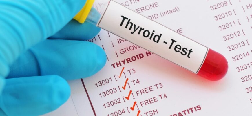 Що таке харчові отруєння: ознаки, причини та методи запобігання