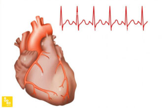 Тахікардія: Основні Причини, Симптоми та Методи Лікування