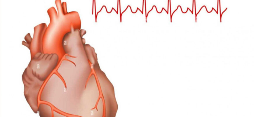 Тахікардія: Основні Причини, Симптоми та Методи Лікування