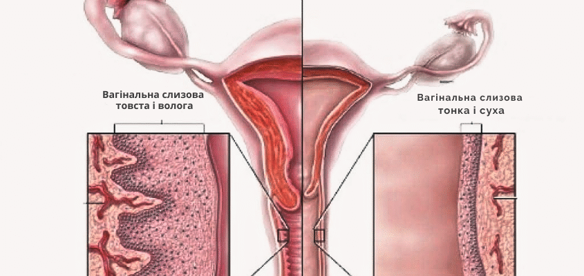 Вагініт: Симптоми, Причини та Лікування Запалення Піхви