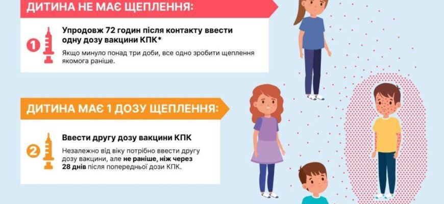 Що таке кір: симптоми, профілактика та лікування вірусного захворювання