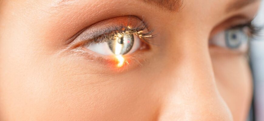 Глаукома глаза: что это такое, причины и лечение заболевания