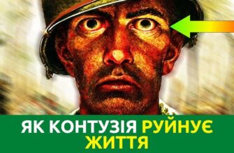 Контузія: визначення, симптоми та методи лікування травми голови