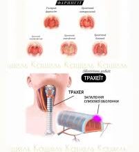 Кашель: Причини, типи та ефективні методи лікування для здоров’я