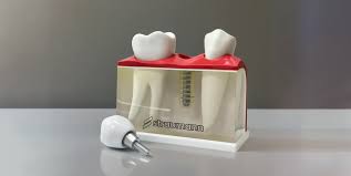 Імплементація: Пояснення терміну та його значення в сучасному світі