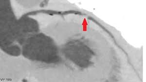 Що таке КПІ: Розкриття Теоретичних і Практичних Аспектів Кредитів