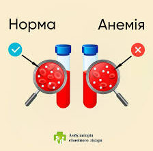 Залізо: Важливість, Властивості та Його Роль у Вашому Здоров’ї