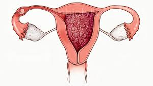 Що таке Загальне захворювання: Огляд, симптоми та методи лікування