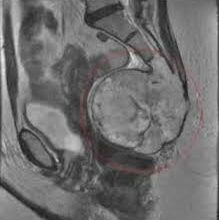 Що таке куприк: роль та особливості будови у людському організмі
