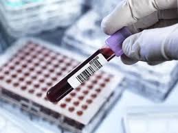 Що таке креатинін в крові: визначення, норми та медичне значення