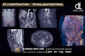Що таке Контраст: Визначення, приклади та значення у повсякденні