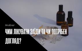 Що таке заїди: Причини, симптоми і ефективні методи лікування