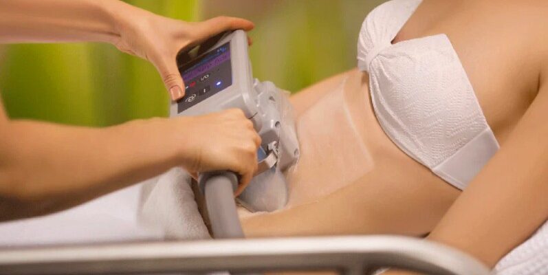 Криолиполиз: Эффективная и безопасная методика удаления жира