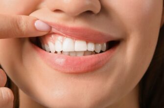 Причины пародонтита и неприятного запаха изо рта: как бороться?