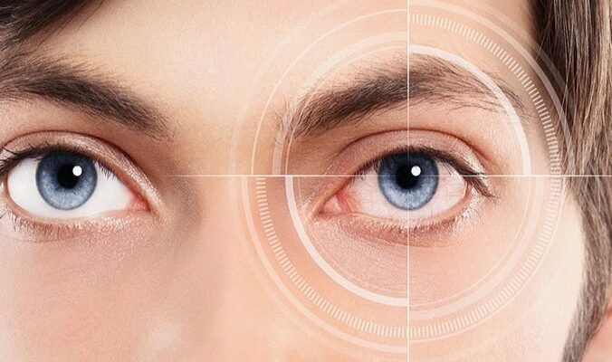 Астигматизм глаз: понимание, причины и методы коррекции зрения Астигматизм глаз: понимание, причины и методы коррекции зрения