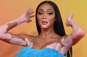 Что такое витилиго: причины, симптомы и методы лечения болезни