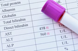 ALT и AST: что это за показатели и почему они важны для здоровья?