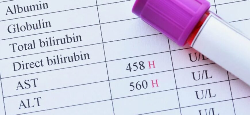 ALT и AST: что это за показатели и почему они важны для здоровья?