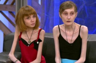 Анорексия: причины, симптомы и способы лечения расстройства